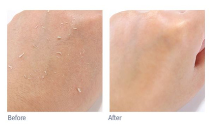 Pyunkang Yul Peeling Gel 100ml